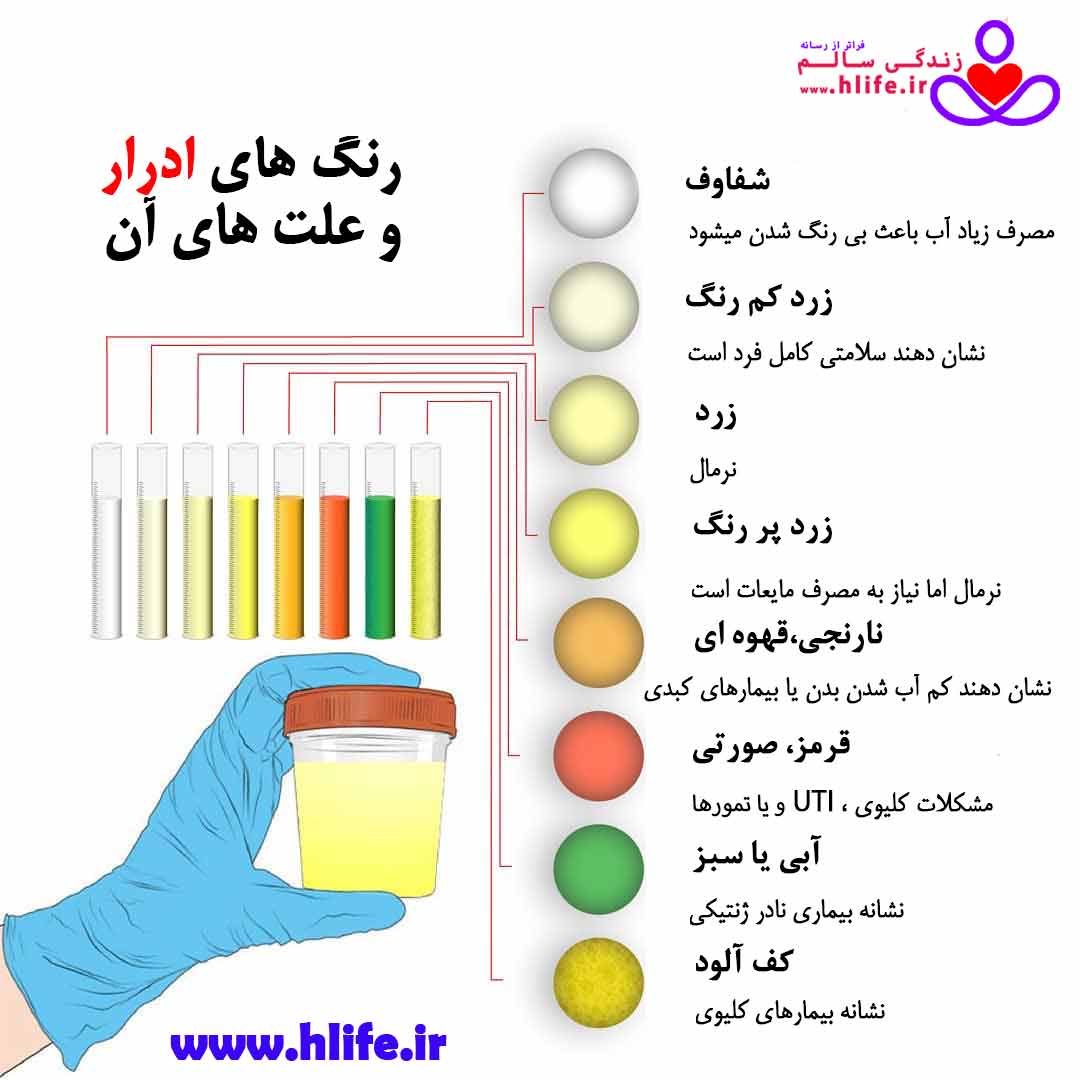 urin color hlife - رنگ ادرار : نشانه ها، تشخیص و فرایند درمان
