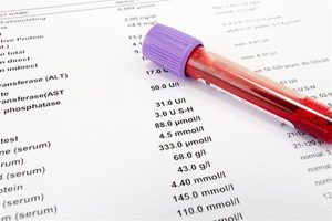20 سوال مهم درباره آزمایش خون 300x200 - 20 سوال مهم درباره آزمایش