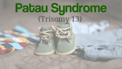 Patau Syndrome 390x220 - سندرم پاتو یا تریزومی ۱۳ چیست؟