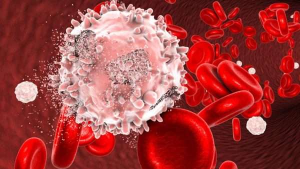 hlife.ir leukemia - هر آنچه باید از سرطان خون بدانید