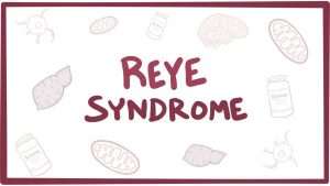 reyes syndrome virtualdr 2 300x169 - شناخت سندروم ری،علائم و درمان آن