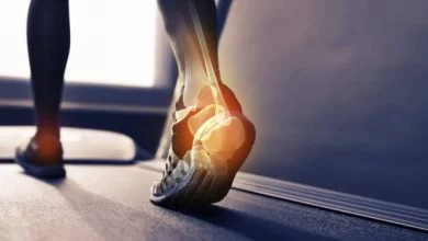 پاشنه8 390x220 - چگونه درد پاشنه پا را درمان کنیم؟