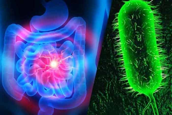 وبا و علائم آن img cholera causes symptoms treatment and prevention 2018 05 - وبا و علائم آن