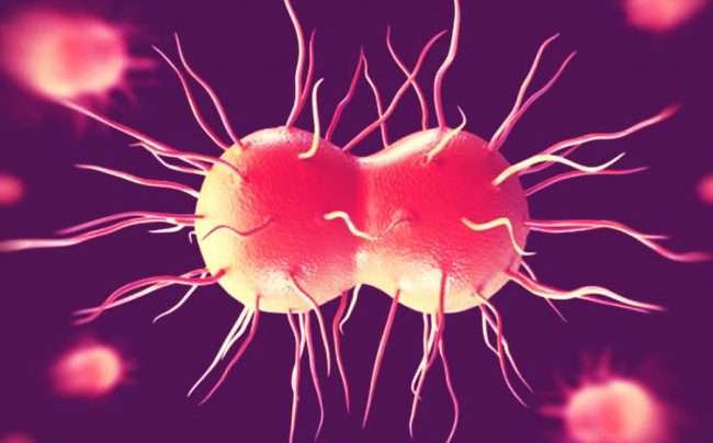 Gonorrhea 2 ppcorn e1499435808952 - هر آنچه باید از سوزاک بدانید