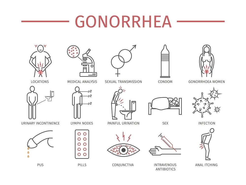 Signs and transmission of gonorrhea - هر آنچه باید از سوزاک بدانید