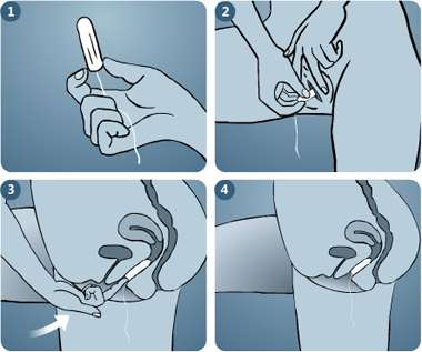 پریود یا عادت ماهانه زنان، هرآنچه در مورد آن باید بدانیم insert tampon - پریود یا عادت ماهانه زنان، هرآنچه در مورد آن باید بدانیم