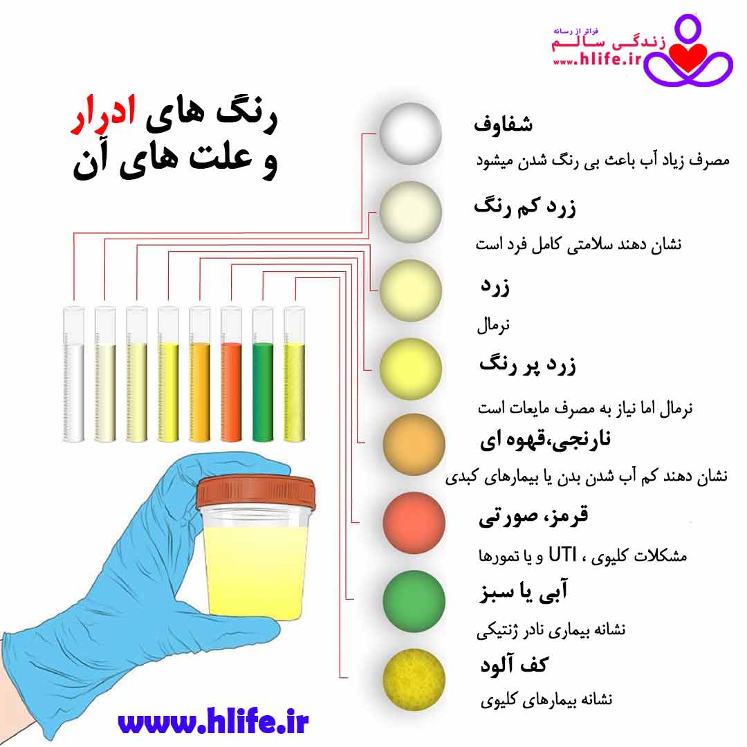 رنگ ادرار : نشانه ها، تشخیص و فرایند درمان urin color hlife - رنگ ادرار : نشانه ها، تشخیص و فرایند درمان