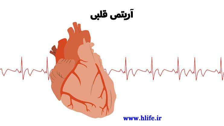 heart-arrhythmia آریتمی قلبی PVC
