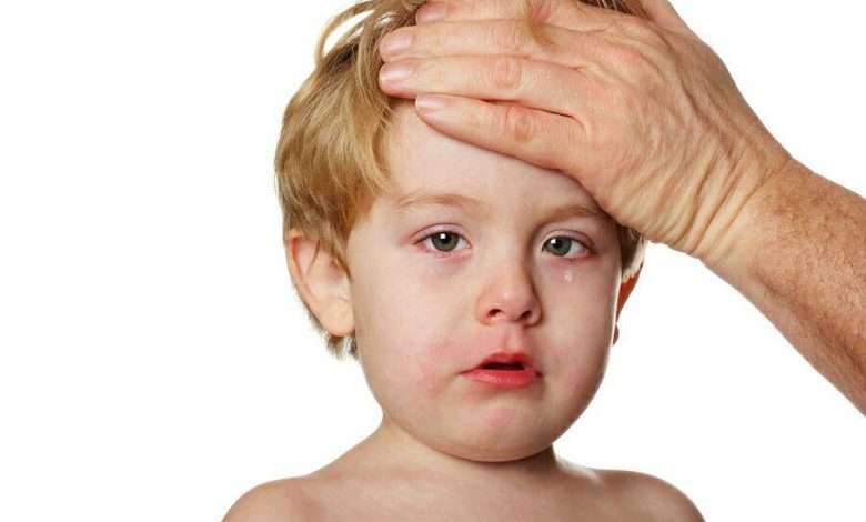 بیماری کاوازاکی؛ علت و علائم Kawasaki syndrome1 780x470 - بیماری کاوازاکی؛ علت و علائم