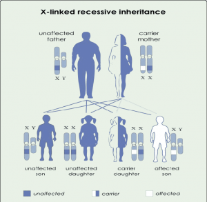 Schematic view of inheritance pattern Lesch Nyhan syndrome 300x293 - سندروم لش نیهان(Lech-Nyhan) چیست؟
