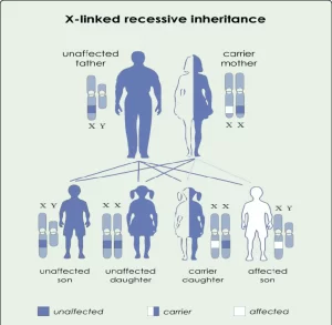 Schematic view of inheritance pattern Lesch Nyhan syndrome 300x293 - سندروم لش نیهان(Lech-Nyhan) چیست؟