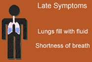 late symptoms - سندرم ریوی هانتاویروس (HPS)