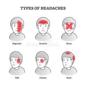types headaches vector illustration labeled educational brain pain set various health problem facial migraine tension 165509718 300x300 - انواع سردرد، علت ها و درمان