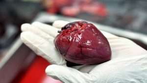 iStock 1135785766 300x169 - wallaby heart organ