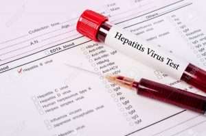 82028354 blood sample for hepatitis b virus hbv testingl on request form screening test 300x199 - World hepatitis day concept.