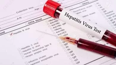 82028354 blood sample for hepatitis b virus hbv testingl on request form screening test 390x220 - آزمایش هپاتیت| هر آنچه باید از آزمایش هپاتیت بدانید.