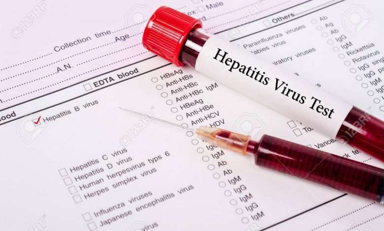 82028354 blood sample for hepatitis b virus hbv testingl on request form screening test 780x470 - آزمایش هپاتیت| هر آنچه باید از آزمایش هپاتیت بدانید.