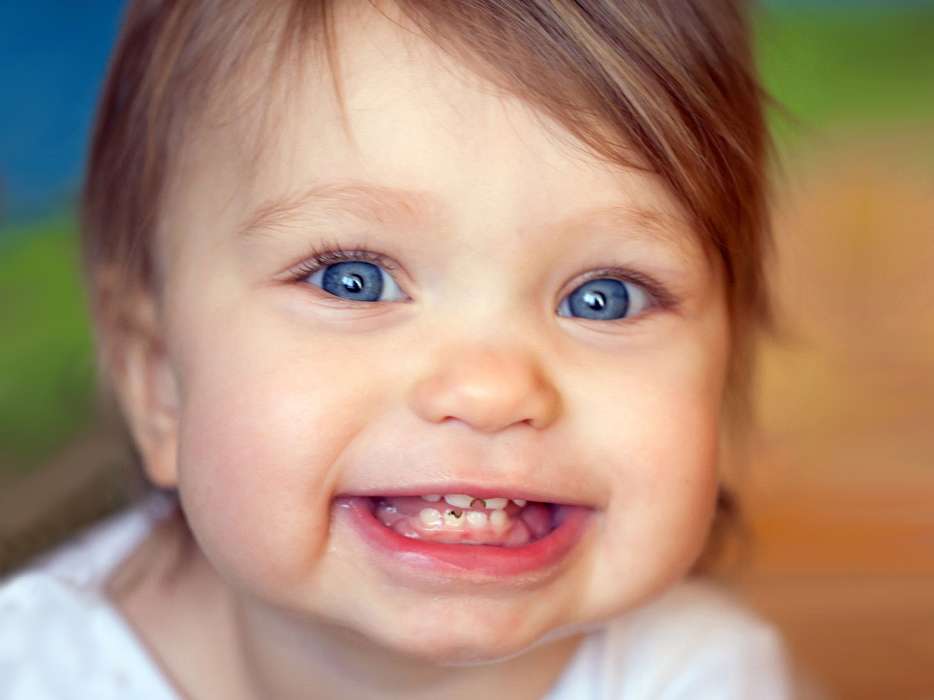 Baby tooth decay - ترتیب دندان درآوردن کودکان