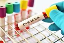 COVID19 test 220x150 - آزمایش کرونا، هر آنچه باید از آزمایش COVID-19 بدانید