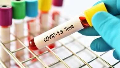 COVID19 test 390x220 - آزمایش کرونا، هر آنچه باید از آزمایش COVID-19 بدانید