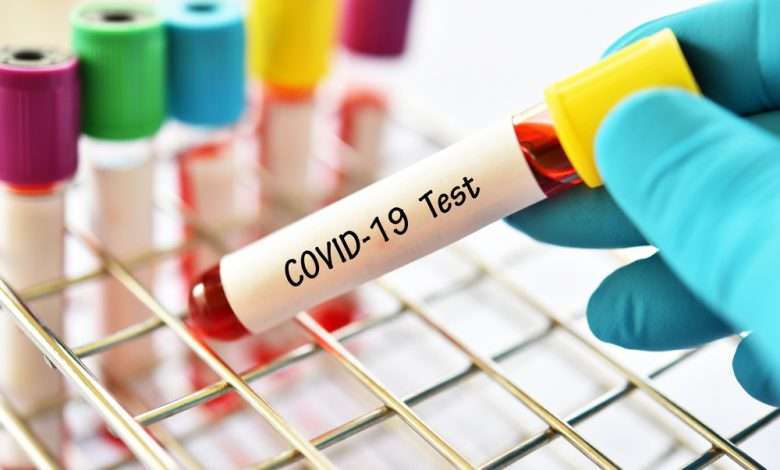 COVID19 test 780x470 - آزمایش کرونا، هر آنچه باید از آزمایش COVID-19 بدانید