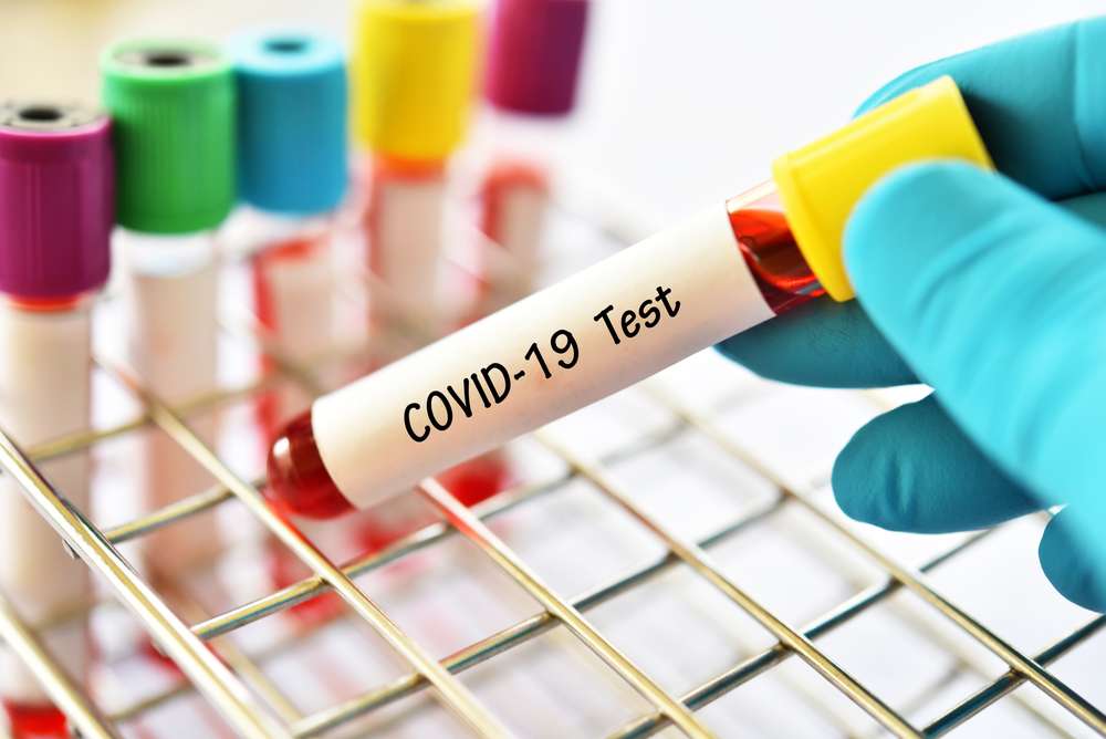 COVID19 test - آزمایش کرونا، هر آنچه باید از آزمایش COVID-19 بدانید