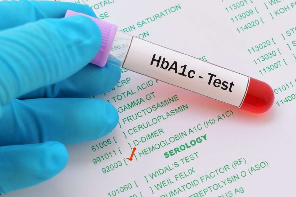 آزمایش HbA1c