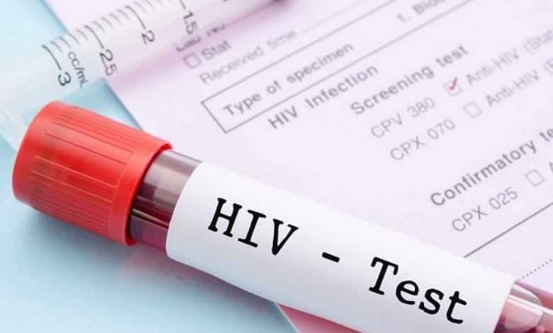 آزمایش ایدز ، آزمایش HIV