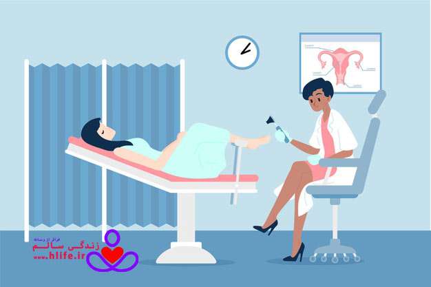 pop-test-hlife تست پاپ اسمیر یا آزمایش پاپ اسمیر
