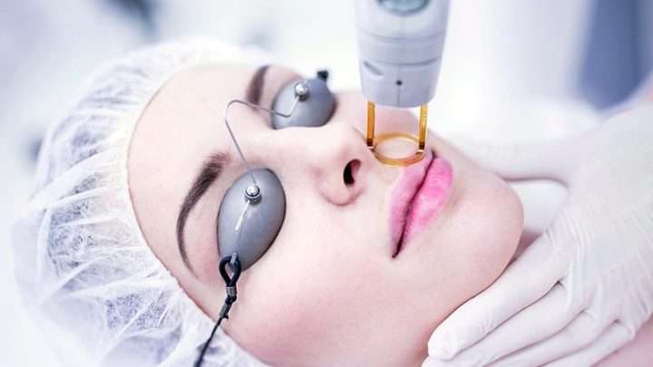 همه چیز درباره ی لیزر موهای زائد rokharaclinic3 720x405 - همه چیز درباره ی لیزر موهای زائد