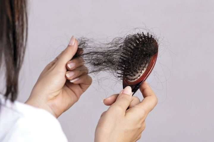 c5f4b3f7 b9bd 42ac a432 b132e94fb7be 720x479 - راه درمان شوره سر و ریزش مو در خانم‌ها و آقایان