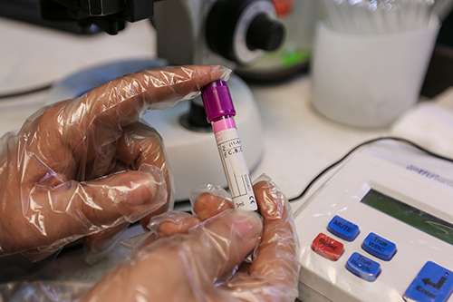 عوامل موثر بر هزینه آزمایش hpv چه هستند؟ 2eb0e730 a0f7 4049 b88b 52047953964b - عوامل موثر بر هزینه آزمایش hpv چه هستند؟