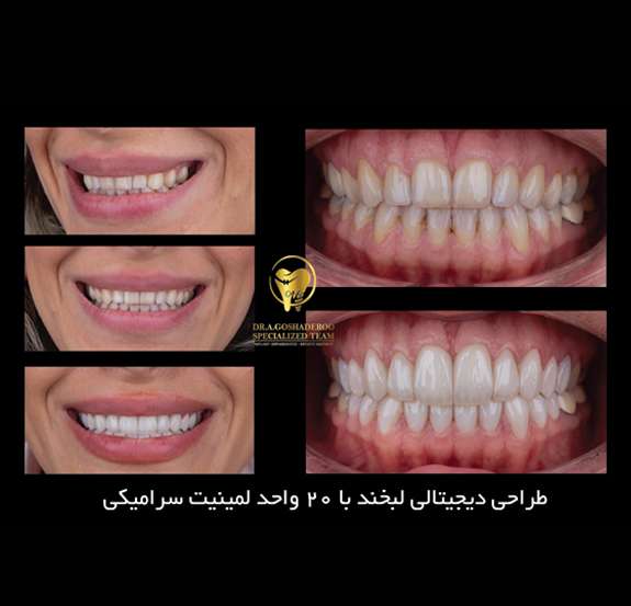 دندانپزشکی زیبایی 