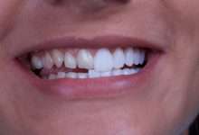 بهترین ارائه دهندگان خدمات پزشکی کامپوزیت دندان