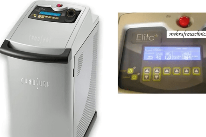 بهترین دستگاه لیزر موهای زائد