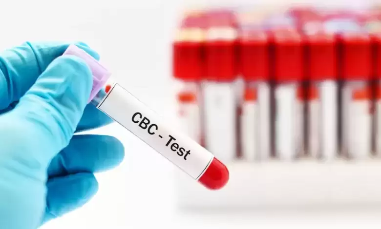 آزمایش خون: بررسی کامل CBC