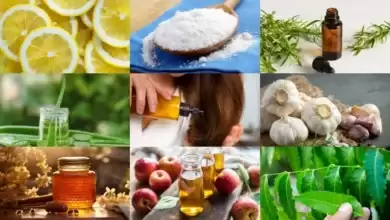 3fb9342e 03aa 4274 8fe7 b2e93bd1ee78 390x220 - درمان گیاهی شوره سر؛ از باورهای سنتی تا راهکارهای علمی