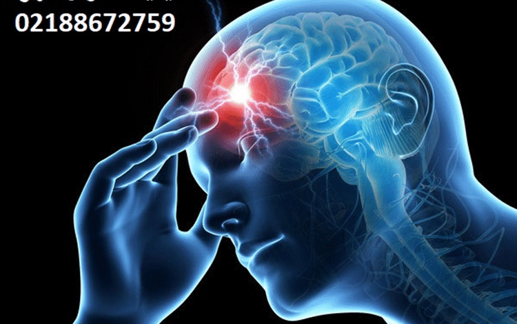 آیا از سردردهای مزمن رنج میبرید؟ کلینیک سردرد تهران، متخصص درمان انواع سردرد ae0df876 c91d 4d4d 973b 7865a267c129 750x470 - آیا از سردردهای مزمن رنج میبرید؟ کلینیک سردرد تهران، متخصص درمان انواع سردرد