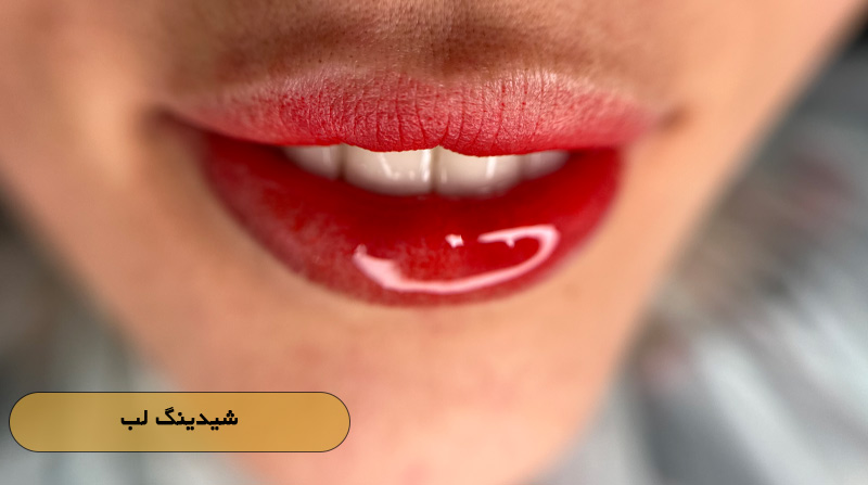 5c7eba03 9315 4c83 81b3 ad773967364b - کلینیک زیبایی مریم حیدری؛ جایی برای زیبایی ماندگار