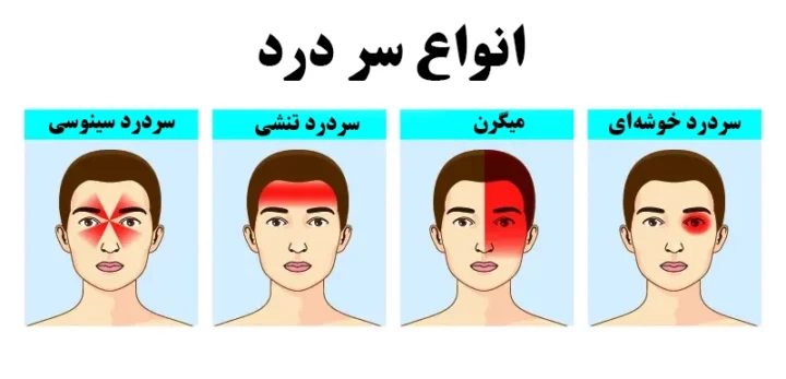 سردرد: راهنمای جامع انواع، علائم خطرناک و جدیدترین درمانها headaches migraines.jpg 1 720x347 - سردرد: راهنمای جامع انواع، علائم خطرناک و جدیدترین درمانها