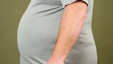 اسلیو معده
