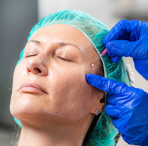 لیفت گونه با نخ یا فیلر گونه؛ کدام گزینه برای شما مناسب تر است؟ 56eec79c 927f 44cb 9dae 73173c37f36c - لیفت گونه با نخ یا فیلر گونه؛ کدام گزینه برای شما مناسب تر است؟