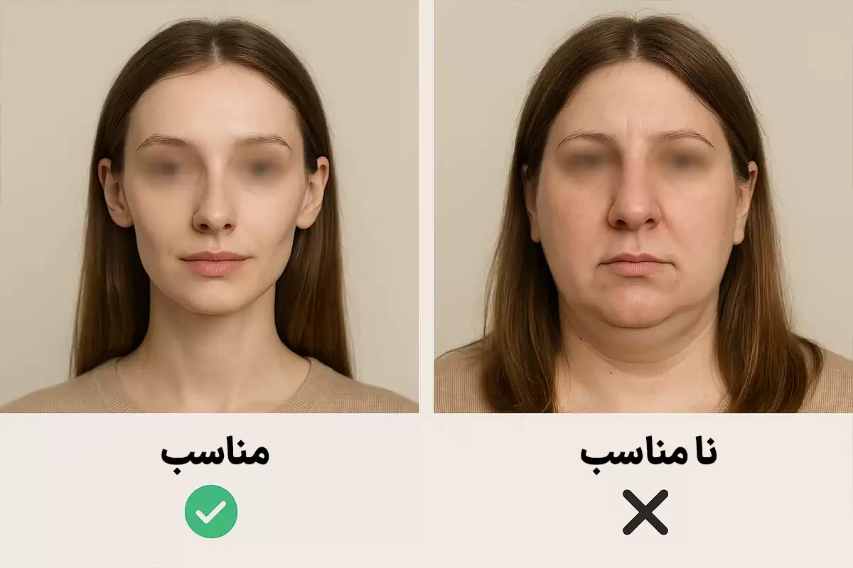 چه کسانی کاندید مناسبی برای عمل بینی نیمه فانتزی هستند؟