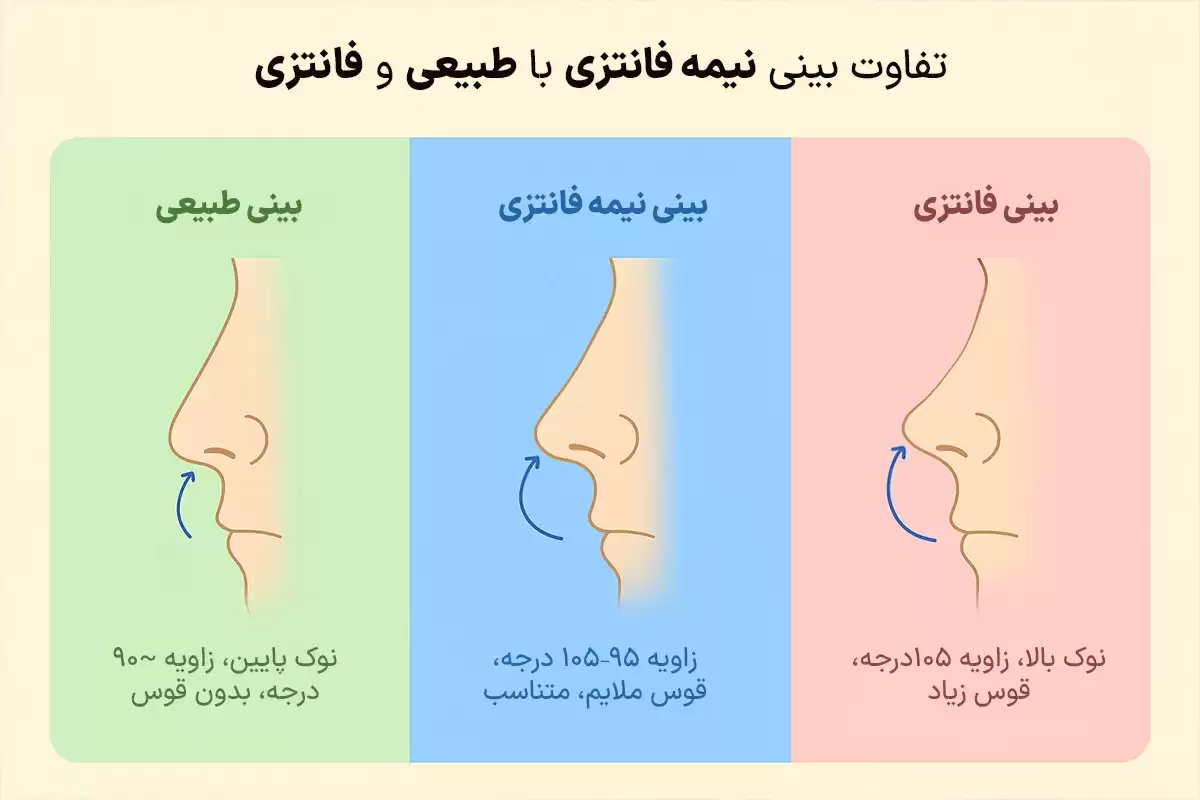 تفاوت بینی نیمه فانتزی با بینی طبیعی و عروسکی