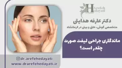 ماندگاری جراحی لیفت صورت چقدر است؟