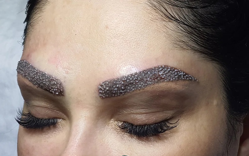 مراحل کاشت ابرو به روش بیوفیبر