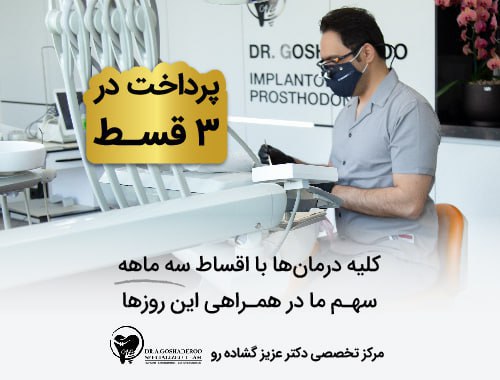 ایمپلنت اقساطی