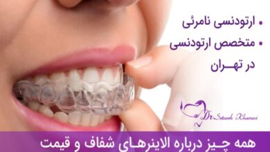 ارتودنسی شفاف
