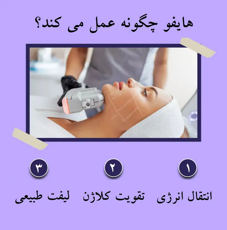هایفو بهتر است یا آر اف