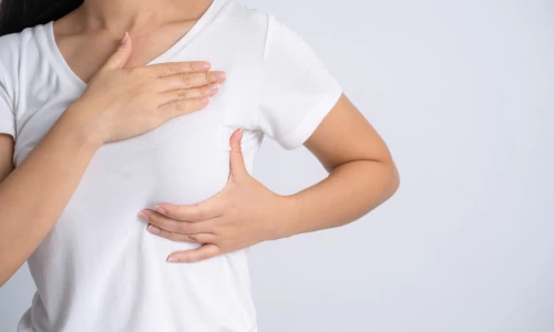 افتادگی و کشیدگی سینه‌ها